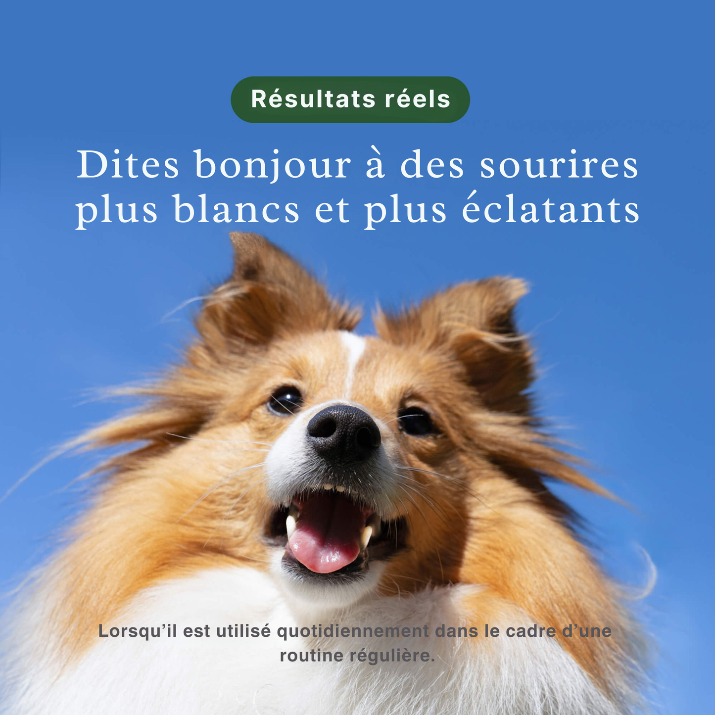 DentaSmile™ - Élimine le tartre en 90 jours